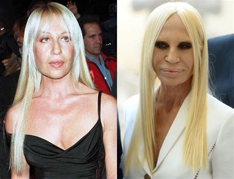 pictures of donatella versace|donatella versace before and after.